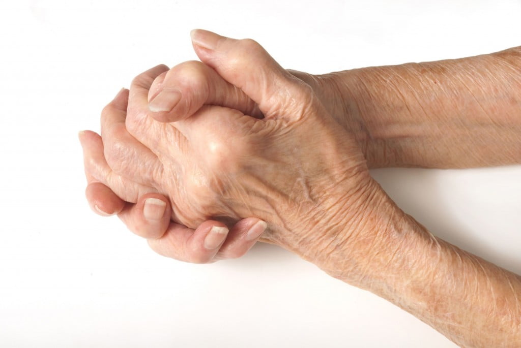 old persons arthritic hands