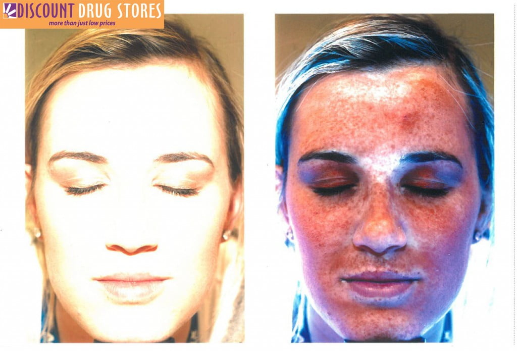 Discount Drug Stores UV camera shows ordinary photo of face next to sun damage visible in UV camera