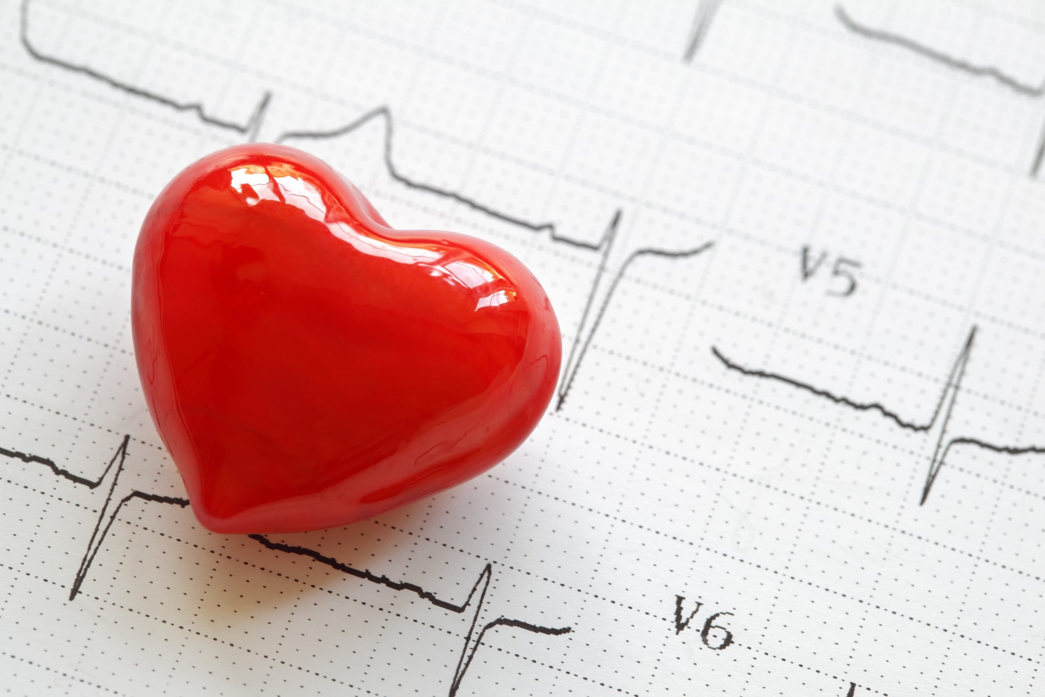 cholesterol: heart on ecg graph