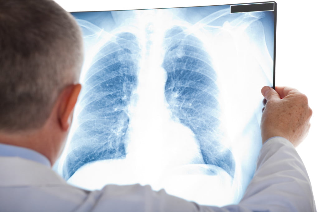 Clinical tips: lung conditions explained | AJP