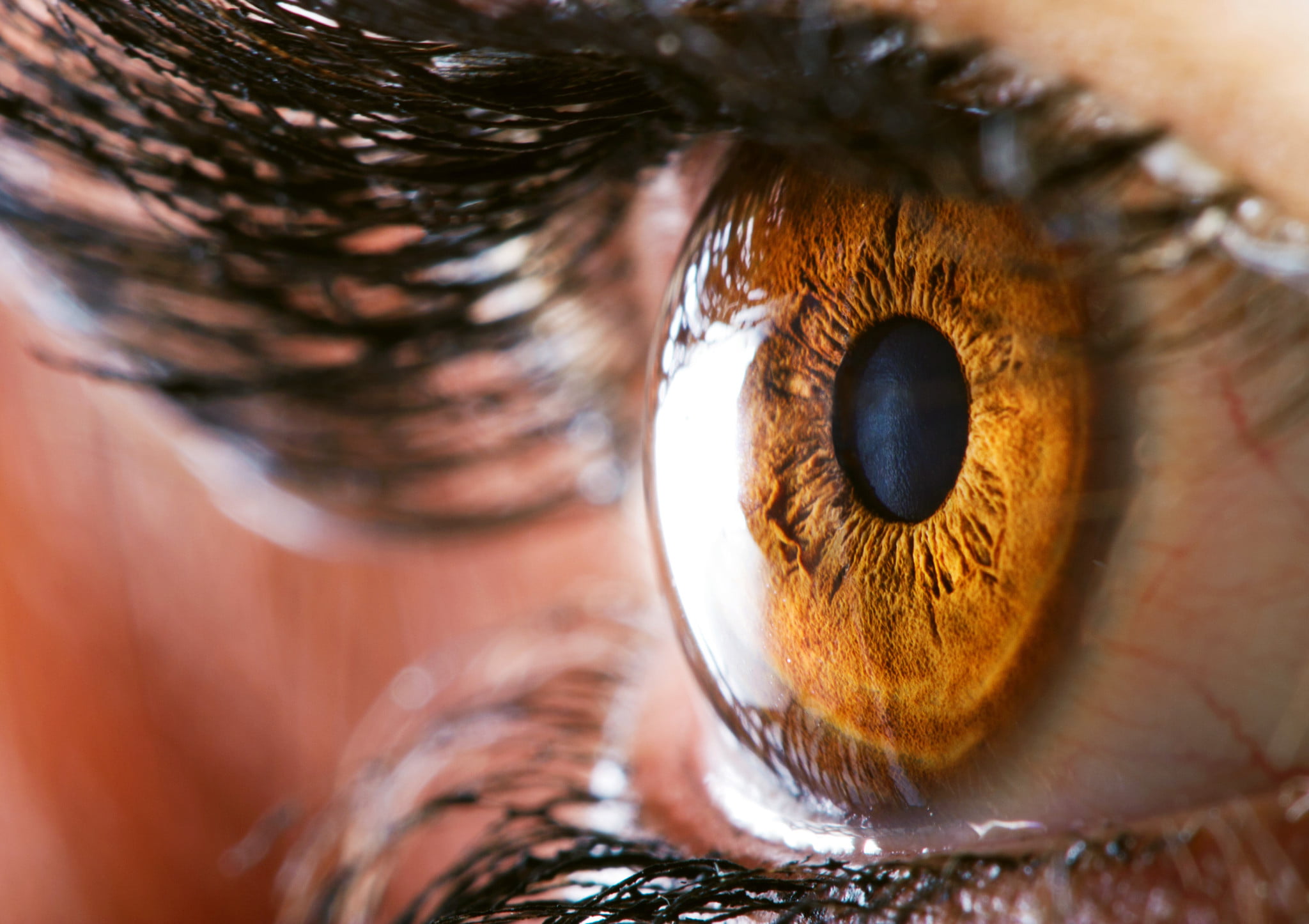macular degeneration: closeup of woman's hazel eye