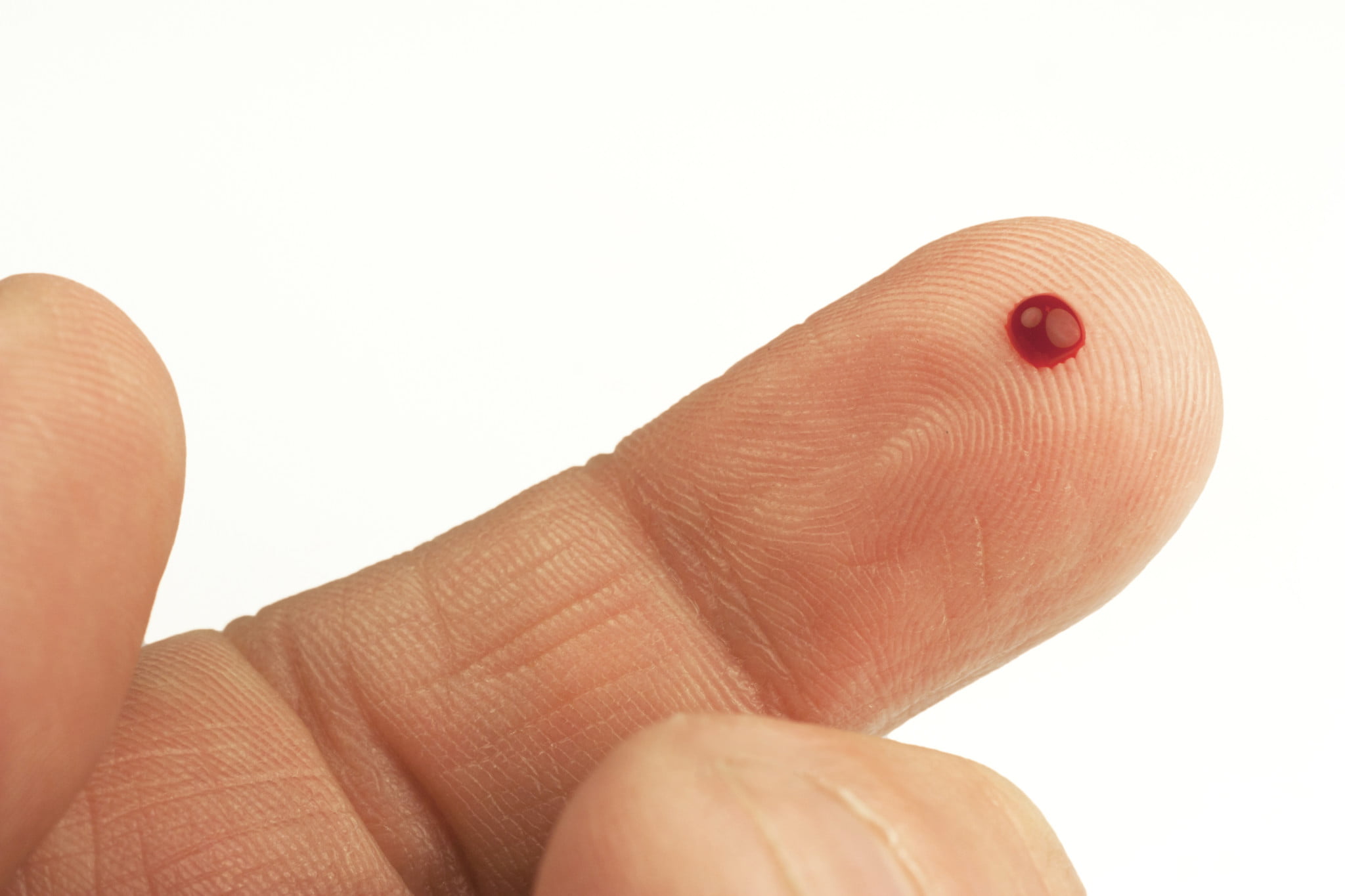 Sigma trials diabetes pilot; index finger with pinprick of blood as in diabetes testing