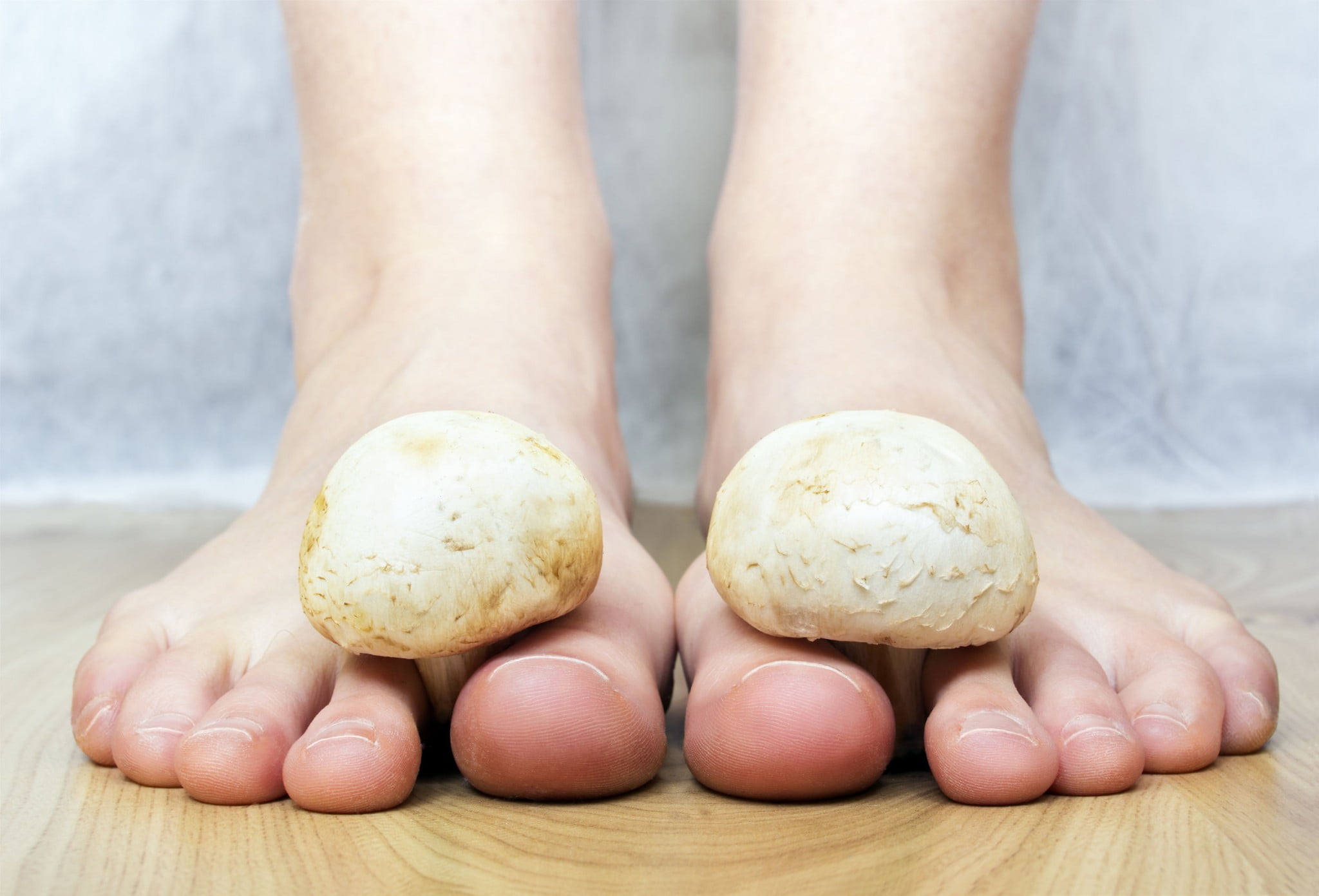 feet with mushrooms: tinea