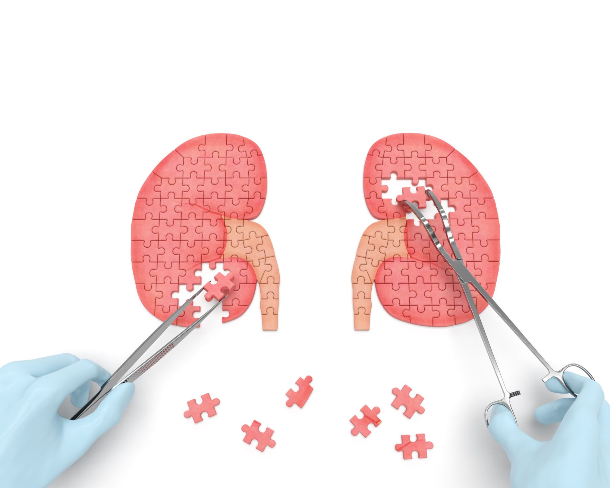 Image of jigsaw puzzle kidneys